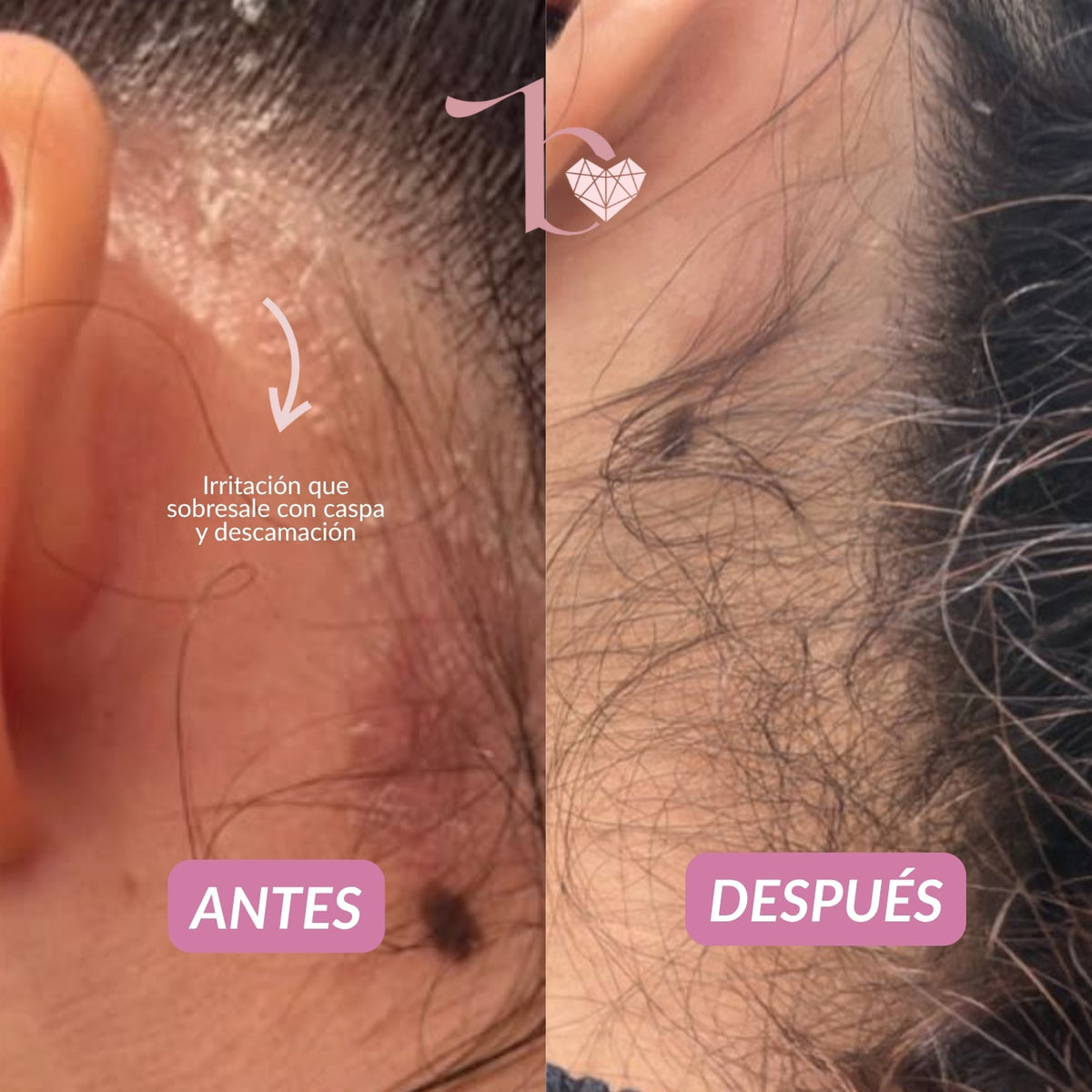 Agua Micelar Capilar Bravura 150ml